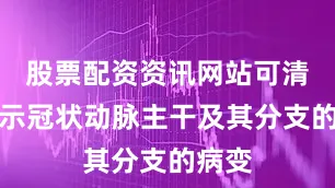 股票配资资讯网站可清晰显示冠状动脉主干及其分支的病变